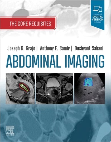 Abdominal Imaging E-Book The Core Requisites