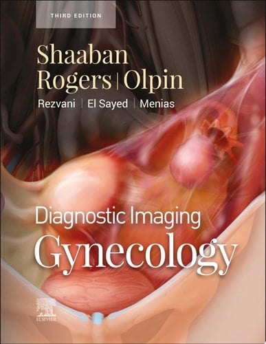 Diagnostic Imaging: Gynecology