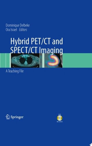 Hybrid PET/CT and SPECT/CT Imaging