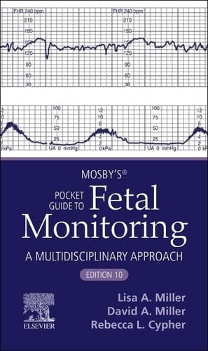 Mosby’s® Pocket Guide to Fetal Monitoring