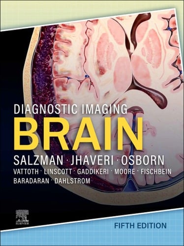 Diagnostic Imaging: Brain