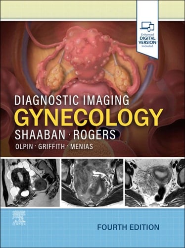 Diagnostic Imaging: Gynecology