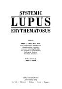 Systemic lupus erythematosus (A Wiley medical publication)