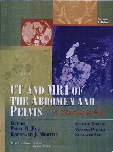 CT and MRI of the Abdomen and Pelvis A Teaching File
