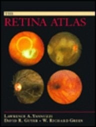 Retina Atlas