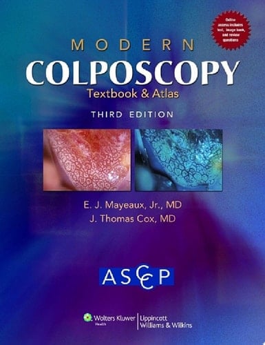 Modern Colposcopy Textbook and Atlas