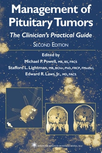 Management of Pituitary Tumors
