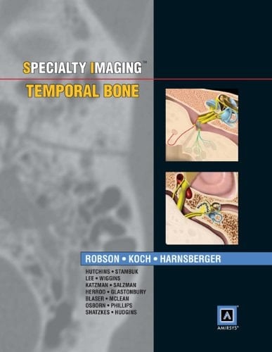 Temporal Bone