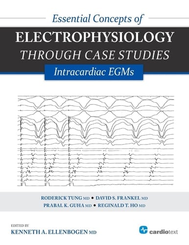 Essential Concepts of Electrophysiology Through Case Studies Intracardiac EGMs