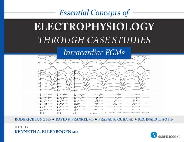Essential Concepts of Electrophysiology through Case Studies: Intracardiac EGMs