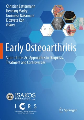 Early Osteoarthritis State-of-the-Art Approaches to Diagnosis, Treatment and Controversies