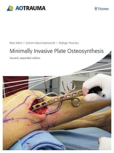 Minimally Invasive Plate Osteosynthesis