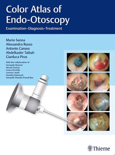 Color Atlas of Endo-Otoscopy Examination - Diagnosis - Treatment