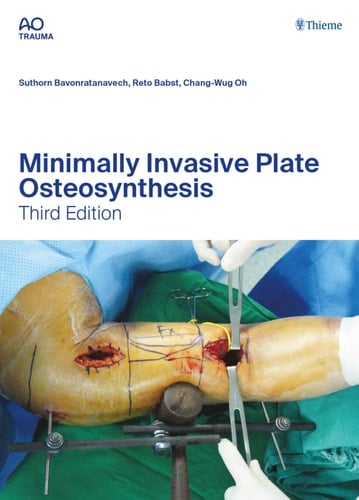 Minimally Invasive Plate Osteosynthesis