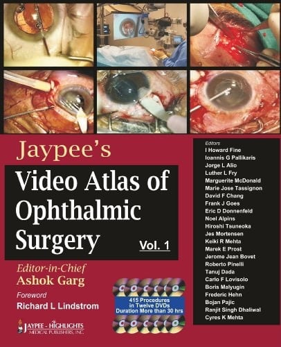 Jaypees Video Atlas of Ophthalmic Surgery with 12 DVD-ROMs