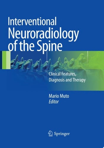 Interventional Neuroradiology of the Spine