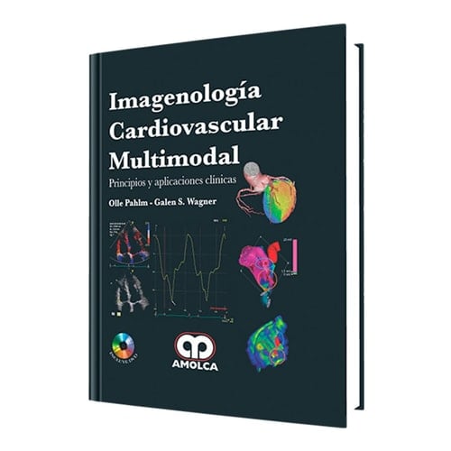 Imagenología cardiovascular multimodal. Principios y aplicaciones clínicas (Spanish Edition)