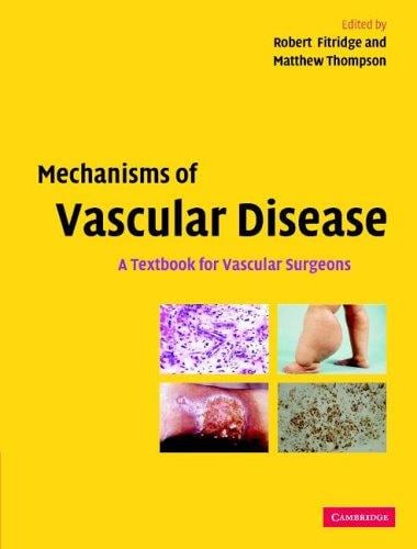 Mechanisms of vascular disease